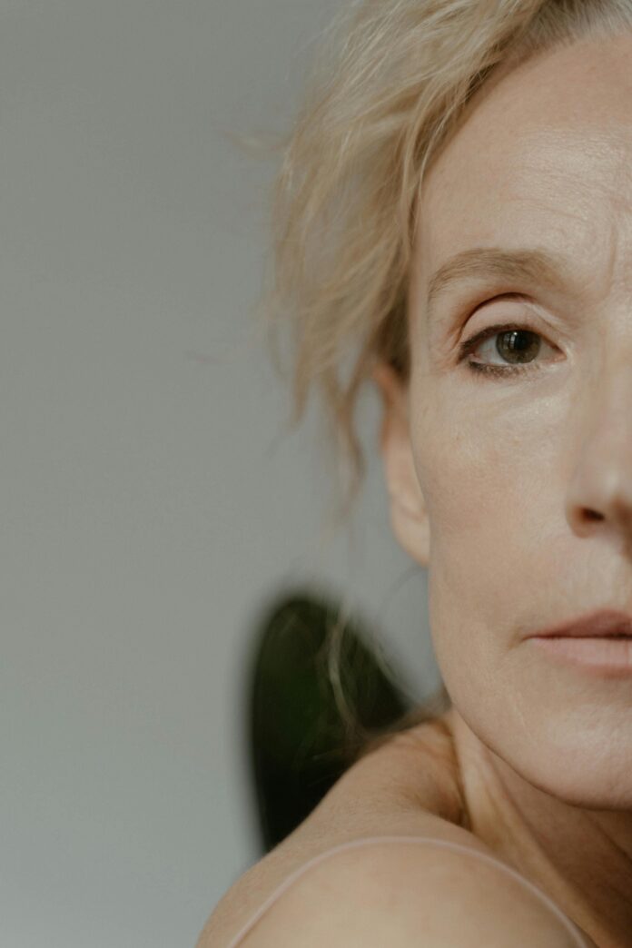 flacidez abaixo dos olhos - foto de capa Fotografia de mulher madura em close, com meia face exposta, utilizada para ilustrar artigo sobre flacidez abaixo dos olhos.